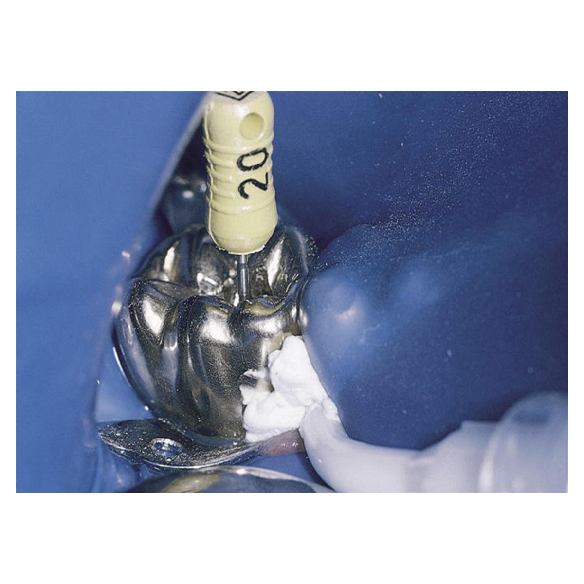 OraSeal Caulking - UP 353, Putty 4 x 1,2 ml