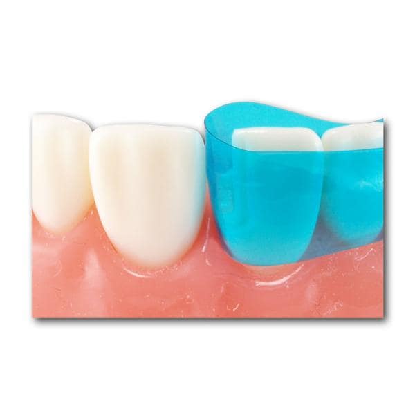 Blue View VariStrip - Verpakking, 50 stuks