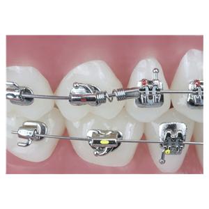 TruFlex NiTi distalizing spring - 700-100, .010" x .045" - 3 stuks