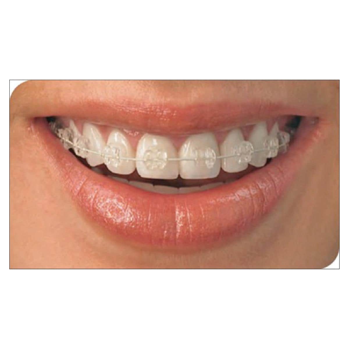 Draad Tooth Tone Coated NiTi Full vorm, rechthoekig - 6000-708, Onder, .018" x .018" - 10 stuks