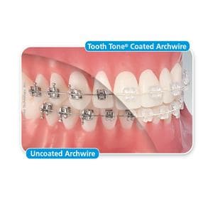 Draad Tooth Tone Coated RVS Full vorm, rechthoekig - 8000-807, Boven .016" x .022" - 10 stuks