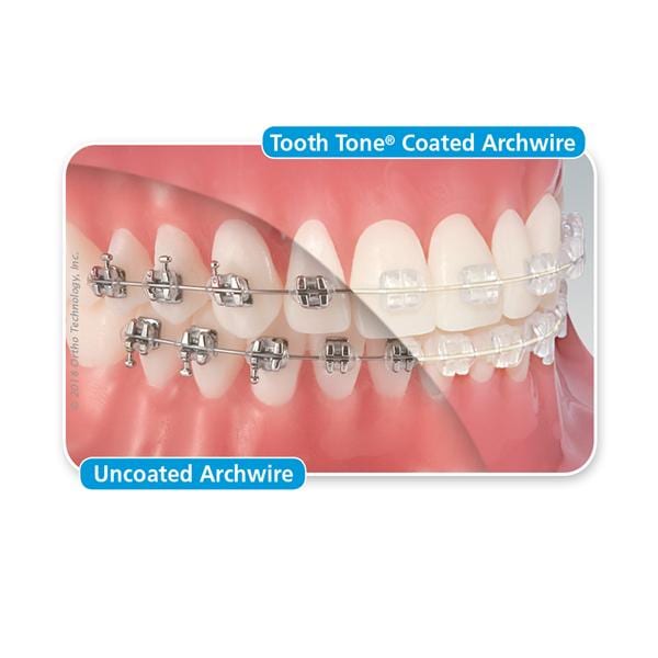 Draad Tooth Tone Coated RVS Full vorm, rechthoekig - 8000-807, Boven .016" x .022" - 10 stuks