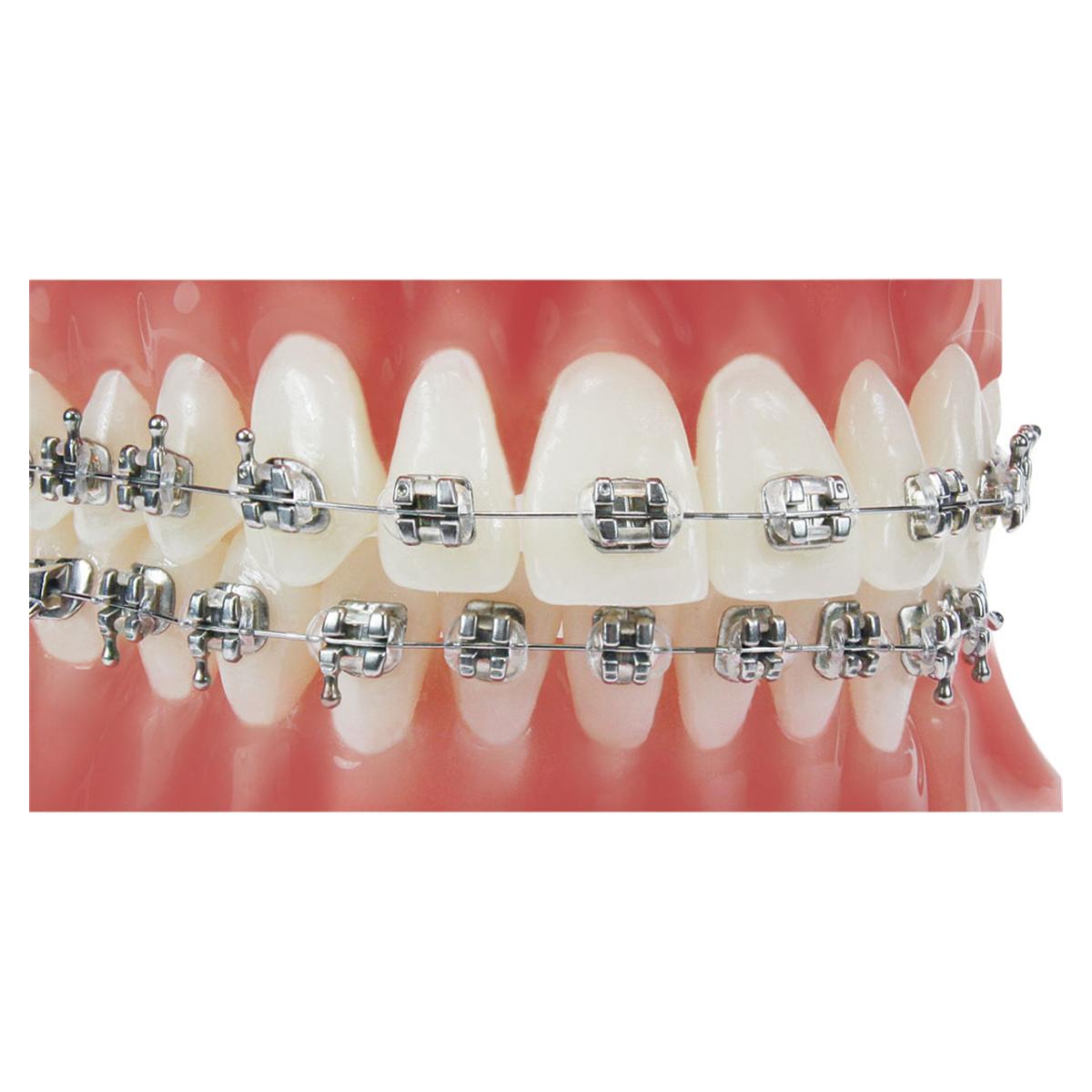 Votion Roth Prescription .018" Slot, Patientenkit - 350-91-2011, Upper/Lower - 5x5 + haken op 3, 4, 5 Offsets (U,L 4,5)