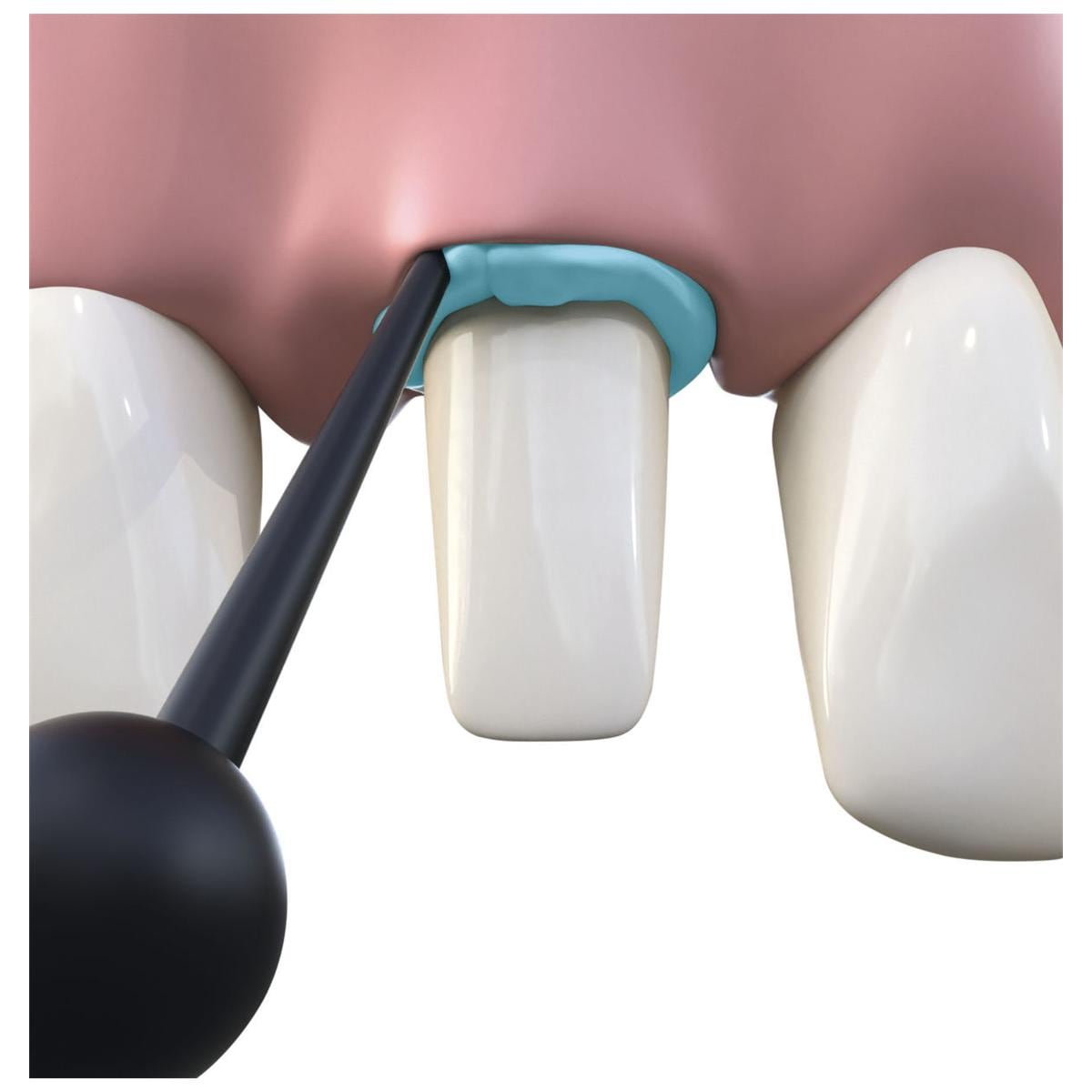 Retraction Paste - Capsules, 100x 0,3g