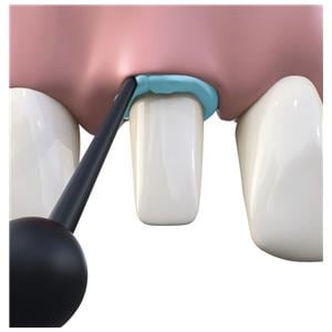 Retraction Paste - Capsules, 100x 0,3g