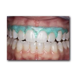 OpalDam Green - Kit 4x 1,2 ml + tips, UP 1824