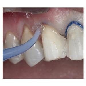 ViscoStat Clear IndiSpense kit - UP 6407