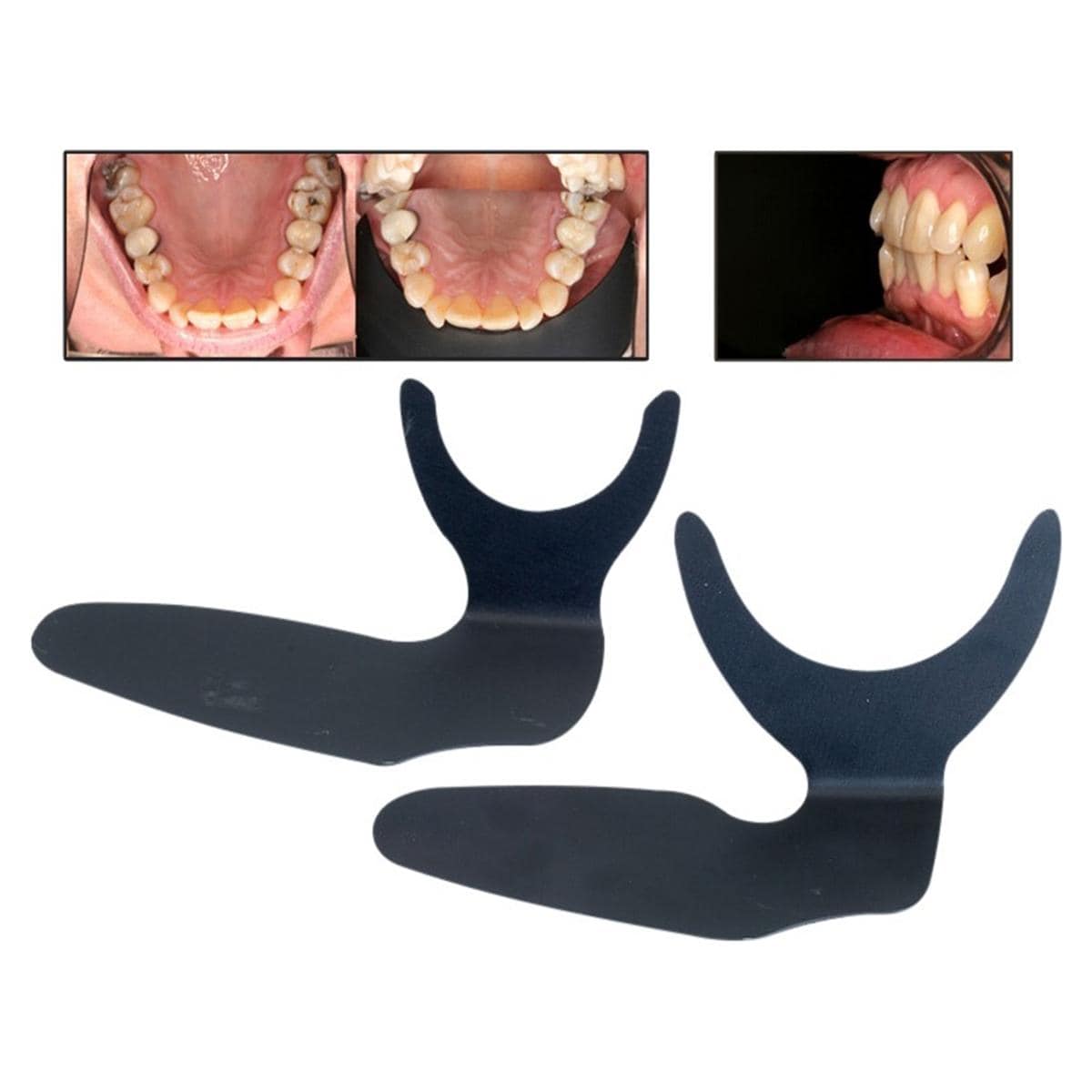 Upper Contrastor set - 190776