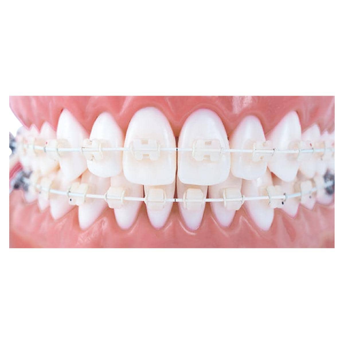 Draad Titanol Cosmetic coated - Boven, .018" x .018" (0,46 x 0,46 mm) - 10 stuks