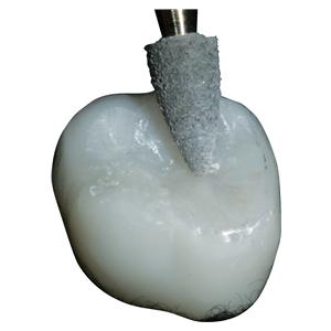 A.S.A.P. Indirect+ IntraOral RA - Starterkit