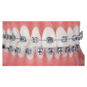 Pinnacle Roth Prescription .022" Slot, Patientenkit - 360-92-2030, Upper/Lower 5x5 + haken op 3 Offsets (U/L 4,5)