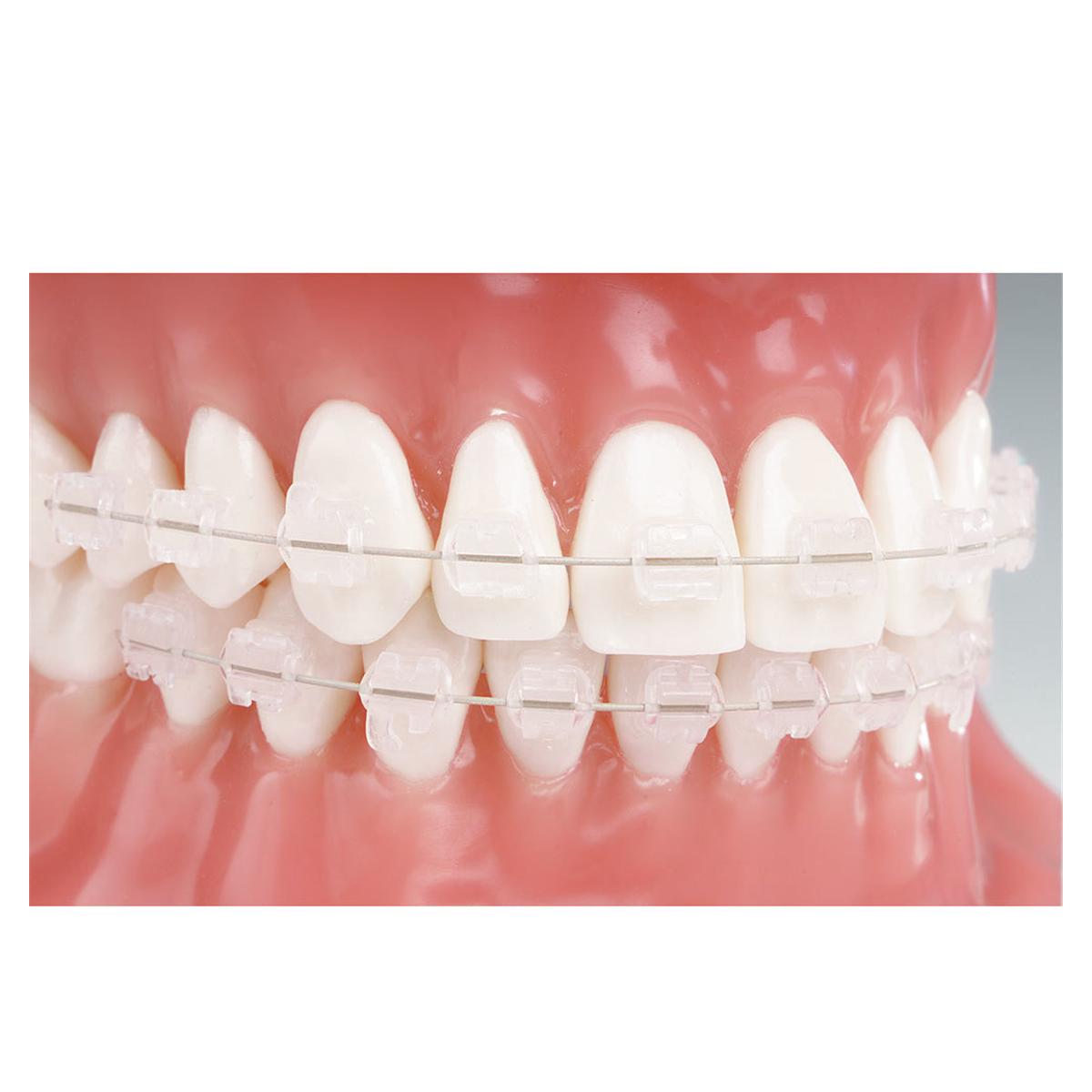 Reflections Roth Prescription .018" Slot, navulling - REF-012, Lateraal UL 22 - 10 stuks
