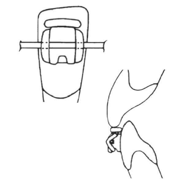 AlastiK Ligature with guard - Clear - 406-430, 10x 10 modules