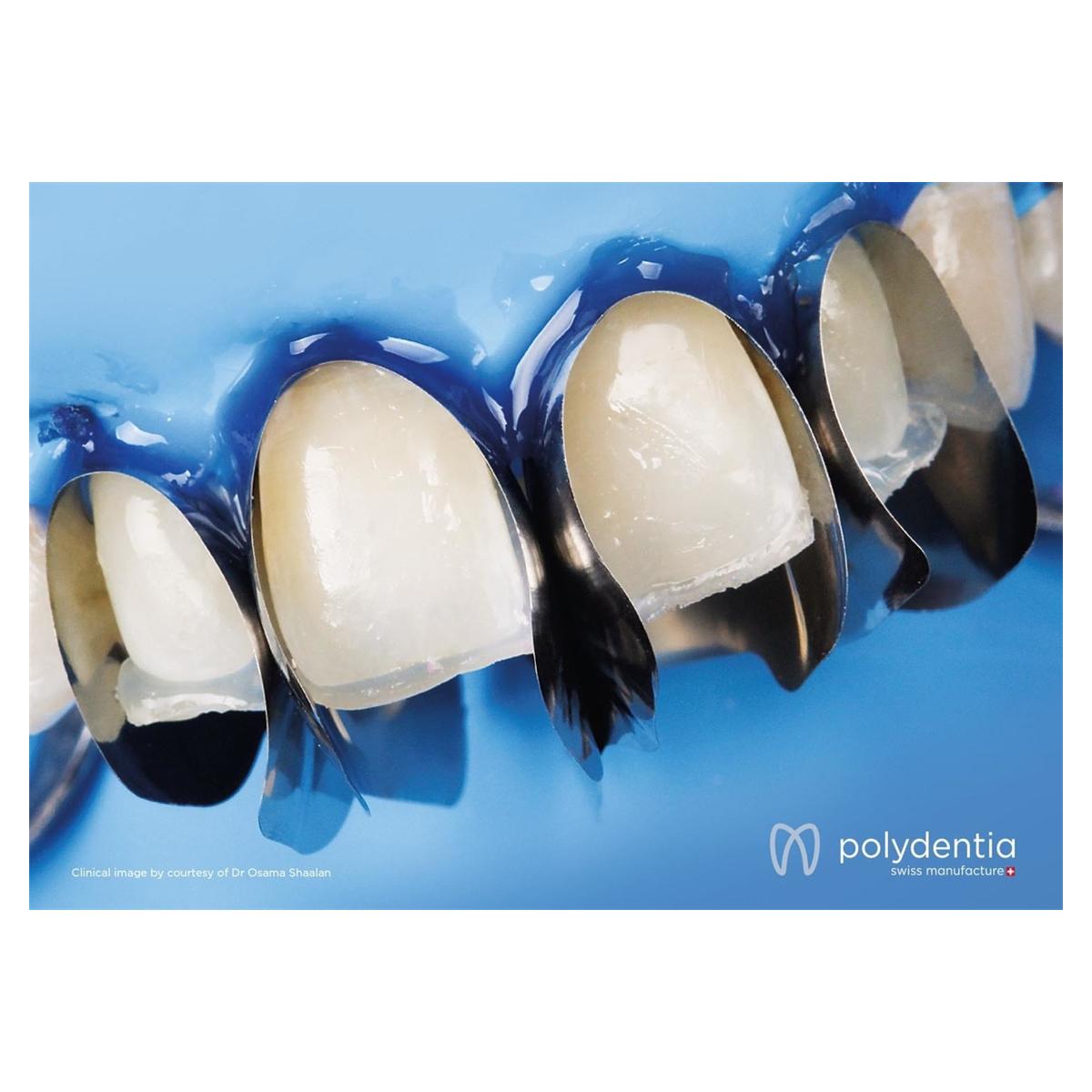 Unica anterior matrix - Verpakking, 12 stuks