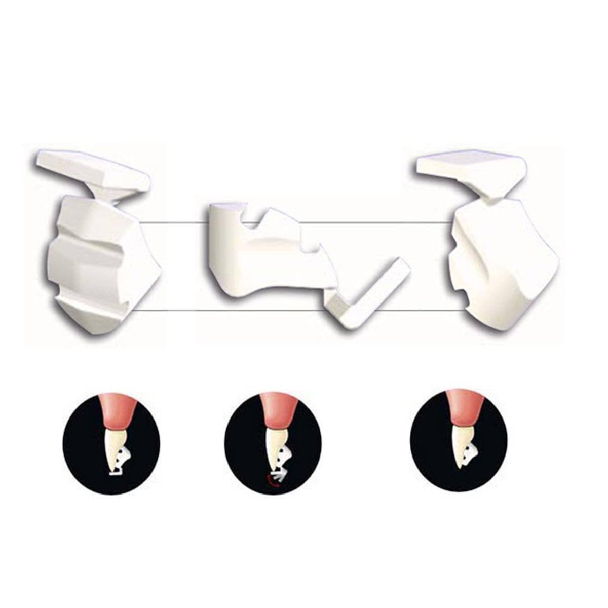 Ceramic Bite Bumper - BB-00-01, 10 stuks