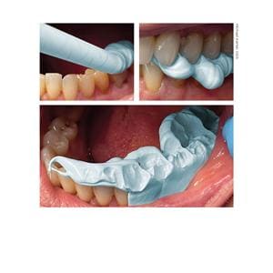 Blu-Mousse Bite Registration Super-Fast (30 sec) - 2x 50 ml en 6 mengtips