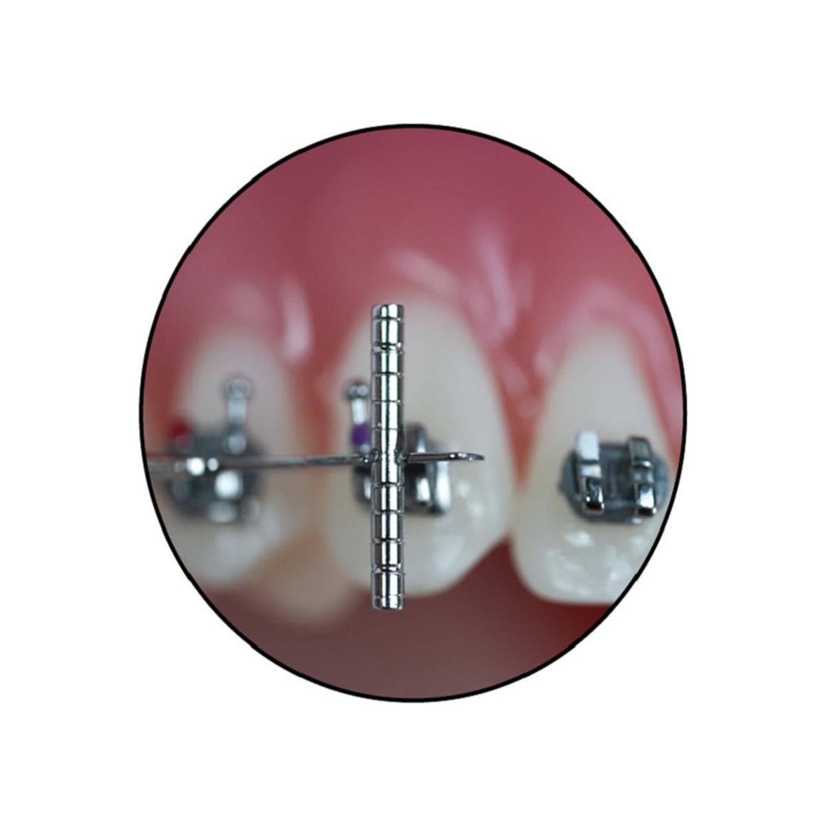 Bracket Navigator - voor slot .022"