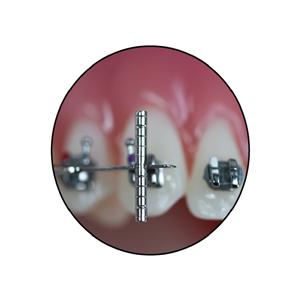 Bracket Navigator - voor slot .022"