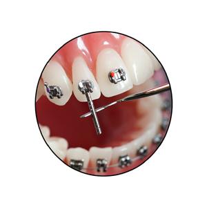 Bracket Navigator - voor slot .022"