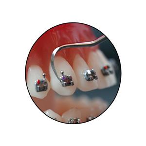 Bracket Navigator - voor slot .022"