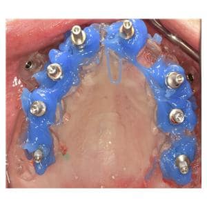 Duroc - Blue, 50ml cartridge + 10 mixing tips