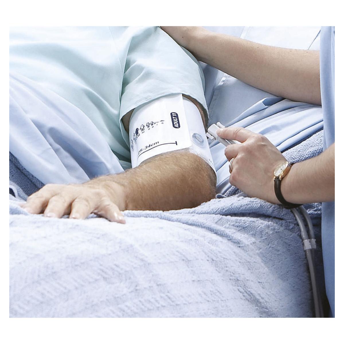 Flexiport manchet disposable - volwassene lang, armomvang 32 - 43cm