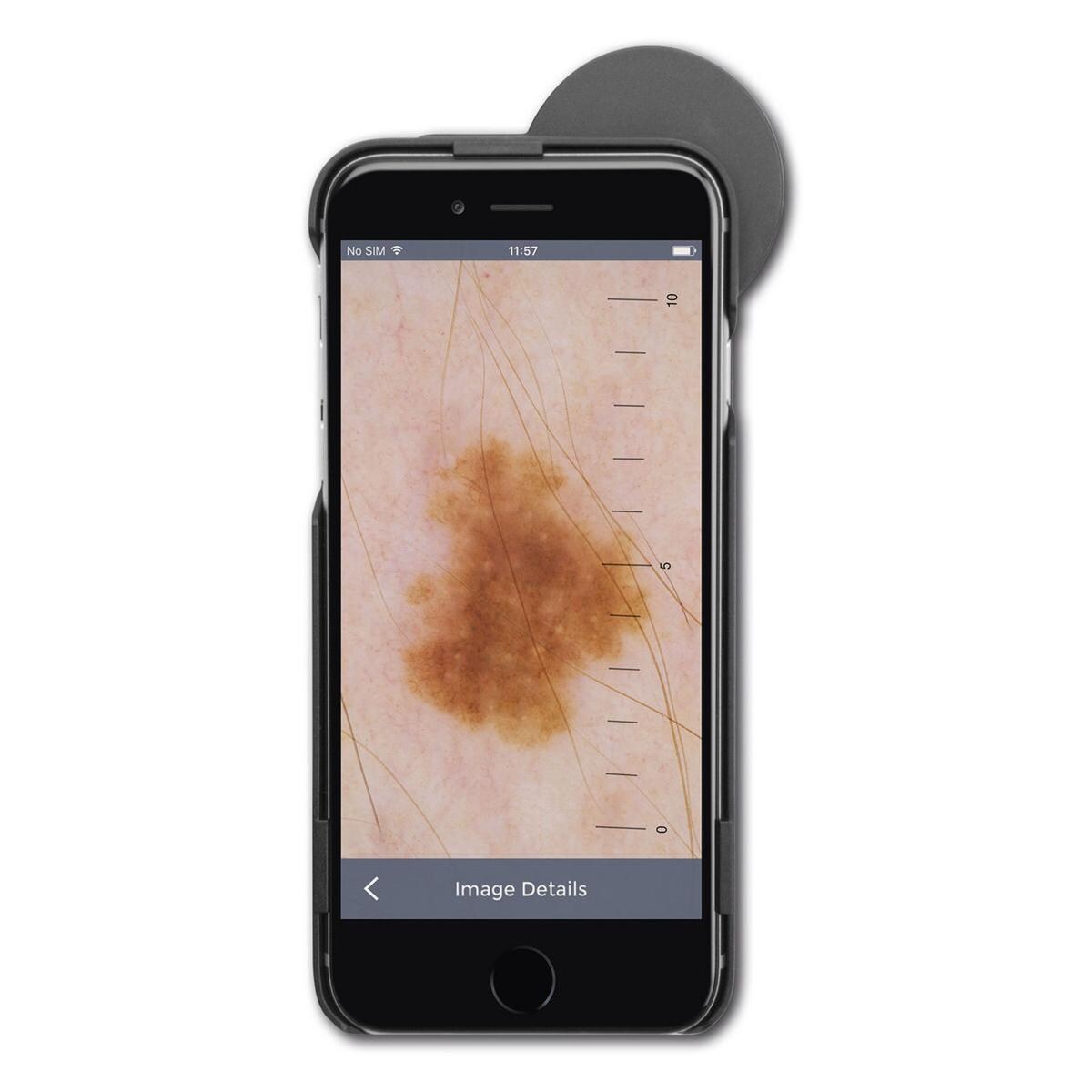 iC1 LED dermatoscoop - iC1 set voor iPhone 7 en 8, met oplader