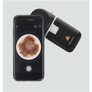 Delta one dermatoscoop - Black/Silver per stuk