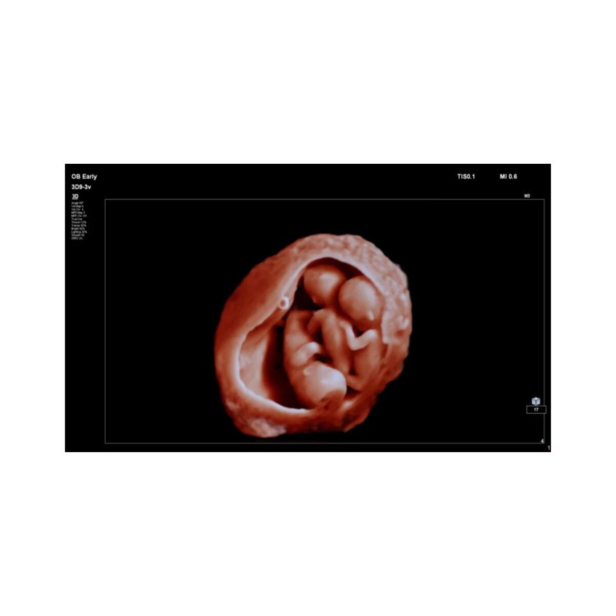 Affiniti 30 Echosysteem - per stuk