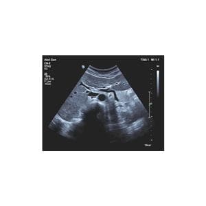 Affiniti 30 Echosysteem - per stuk