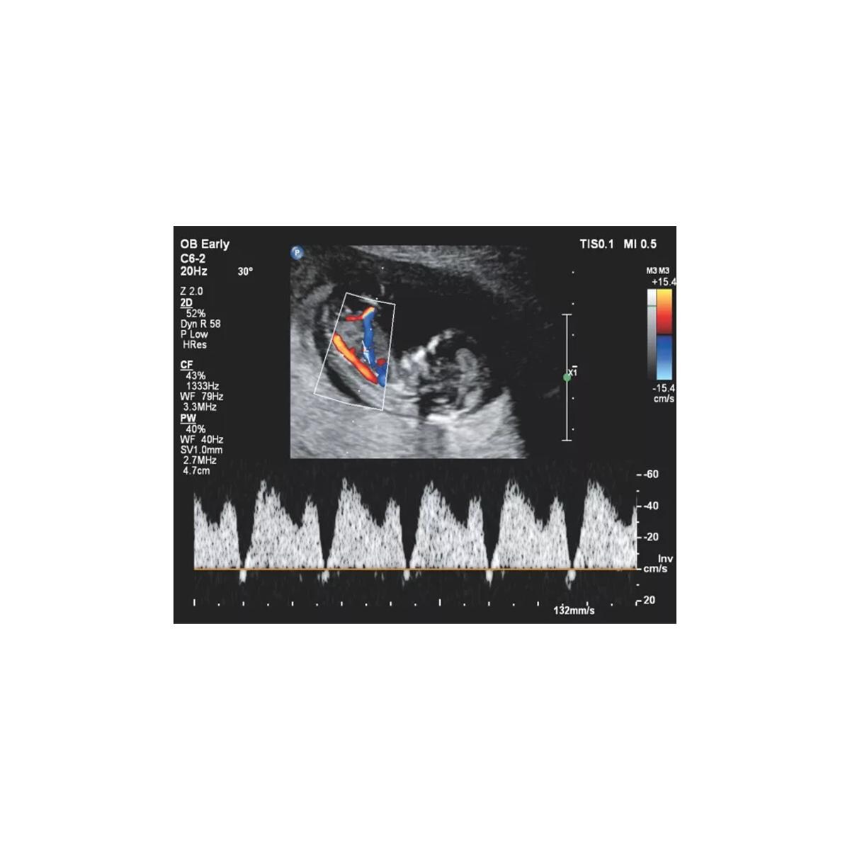 Affiniti 30 Echosysteem - per stuk