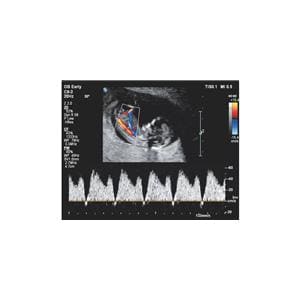 Affiniti 30 Echosysteem - per stuk