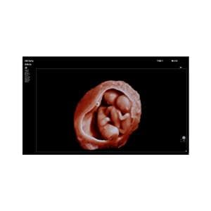Affiniti 70 Echosysteem - per stuk