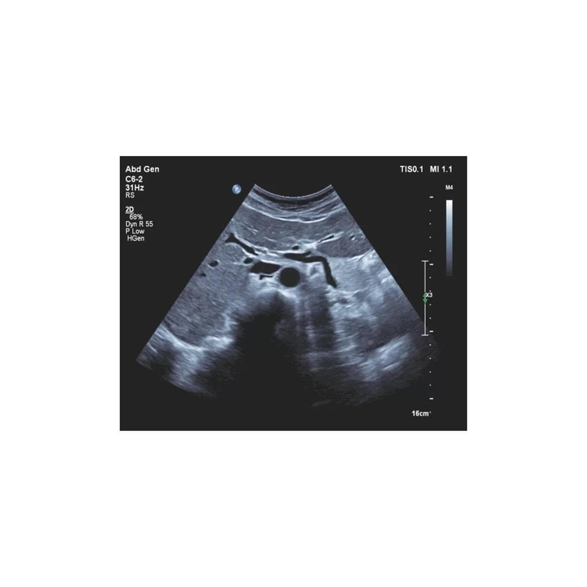 Affiniti 70 Echosysteem - per stuk