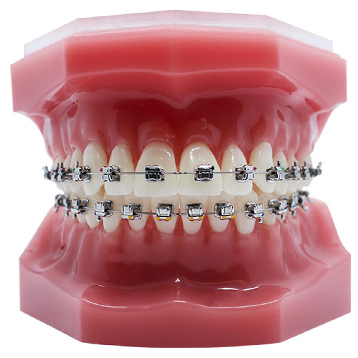 NuStar Gen 2 SLB - Roth 5x5 HKS U & L