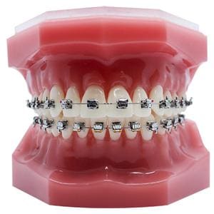 NuStar Gen 2 SLB - Roth 5x5 HKS U & L