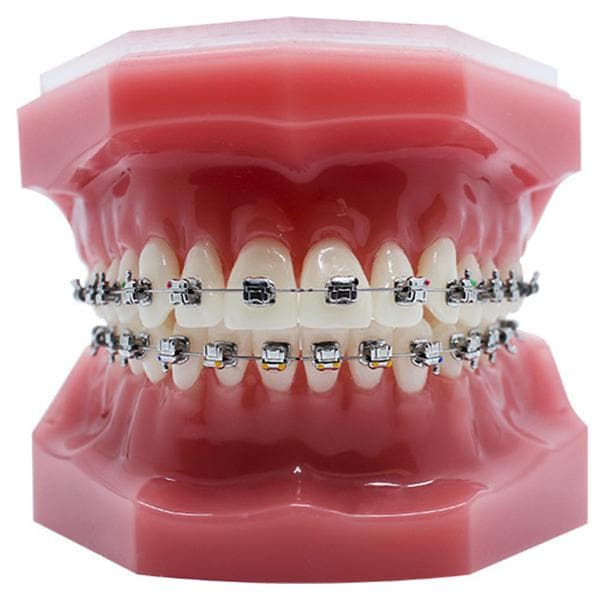 NuStar Gen 2 SLB - Roth 5x5 HKS U & L