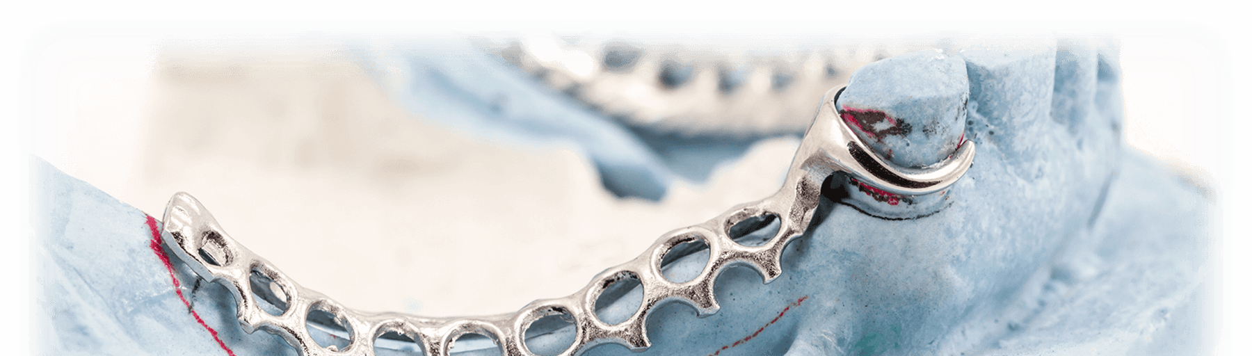 Articulator / Beetregistratie