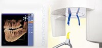 Orthoralix 8500 DDE